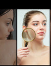 IS YOUR SKIN DRY OR DEHYDRATED, OILY OR LESS OILY? WHAT CAUSES WHAT? FEELING CONFUSED?